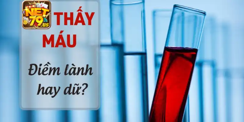Điềm báo ẩn chứa phía sau giấc mơ