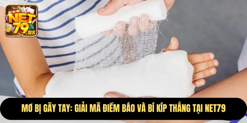 Mơ Bị Gãy Tay